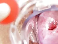 La enfermera cochina se queda një solas